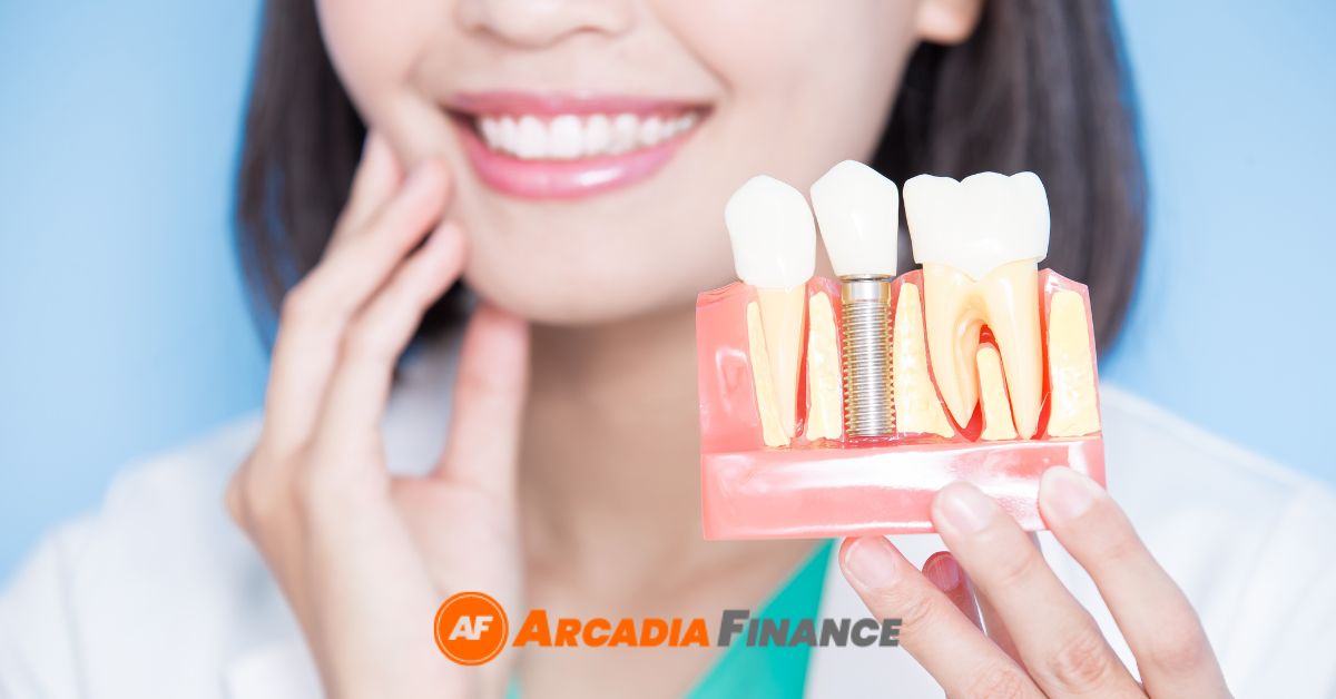 Dental Implants Cost